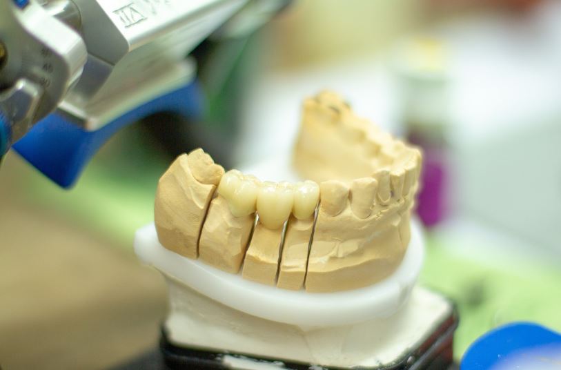 65세이상 노인 의료 혜택: 틀니 임플란트 신청방법