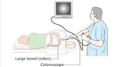 대장내시경이미지