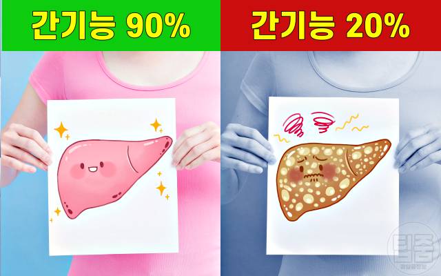 간이 안좋으면 나타나는 증상,간암 증상,간이안좋은증상,팁줌