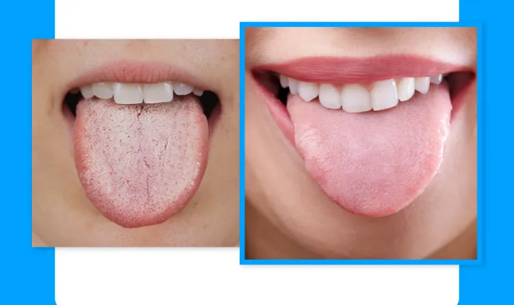 뉴티365-오라플라-바로-구매하기