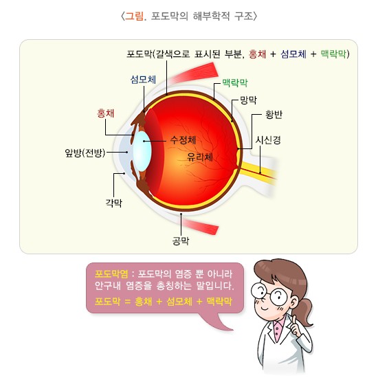 포도막염