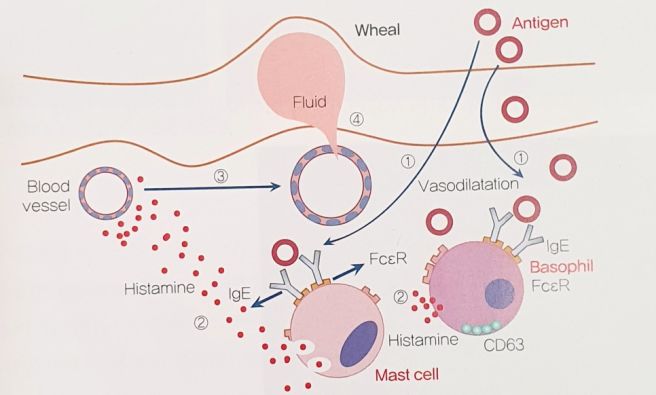 피부 발진 종류
