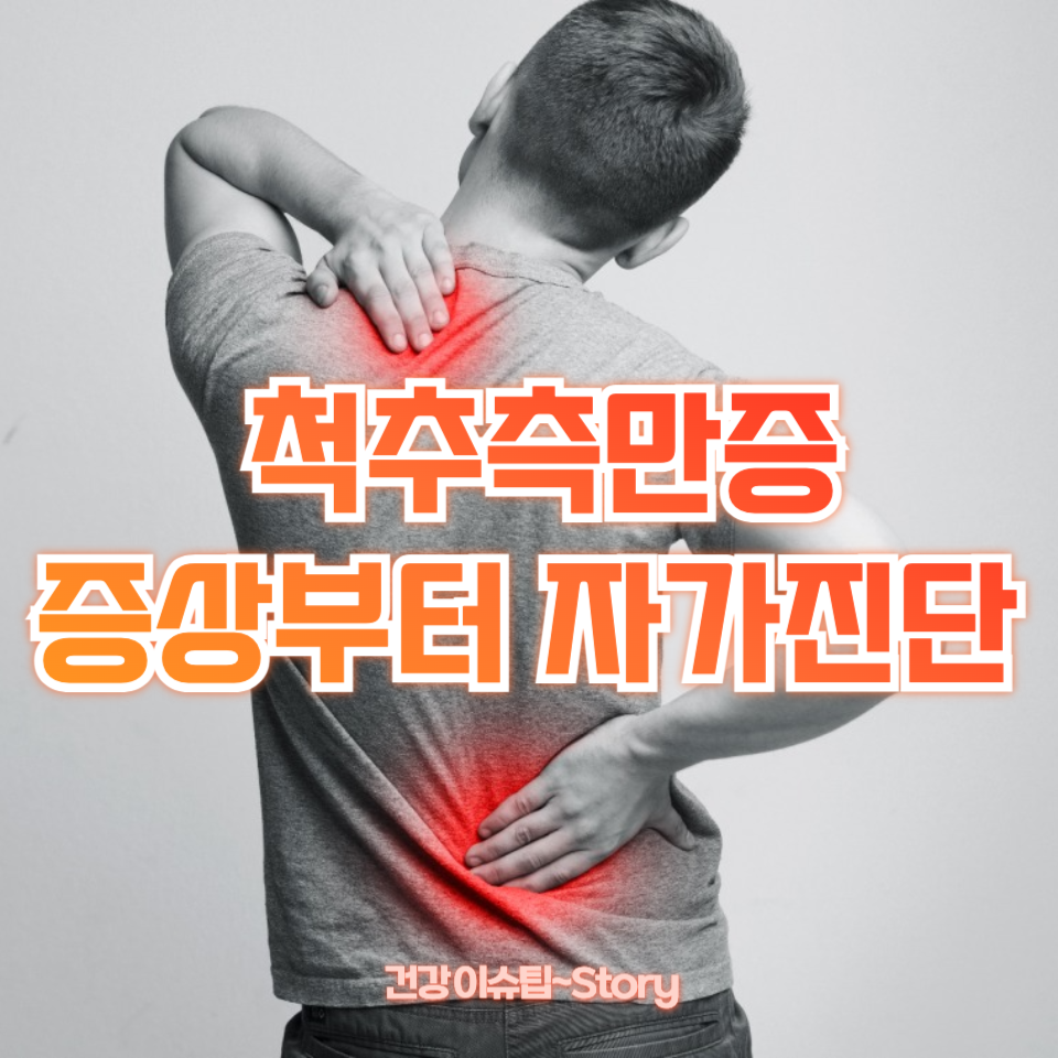 척추측만증 증상부터 자가진단