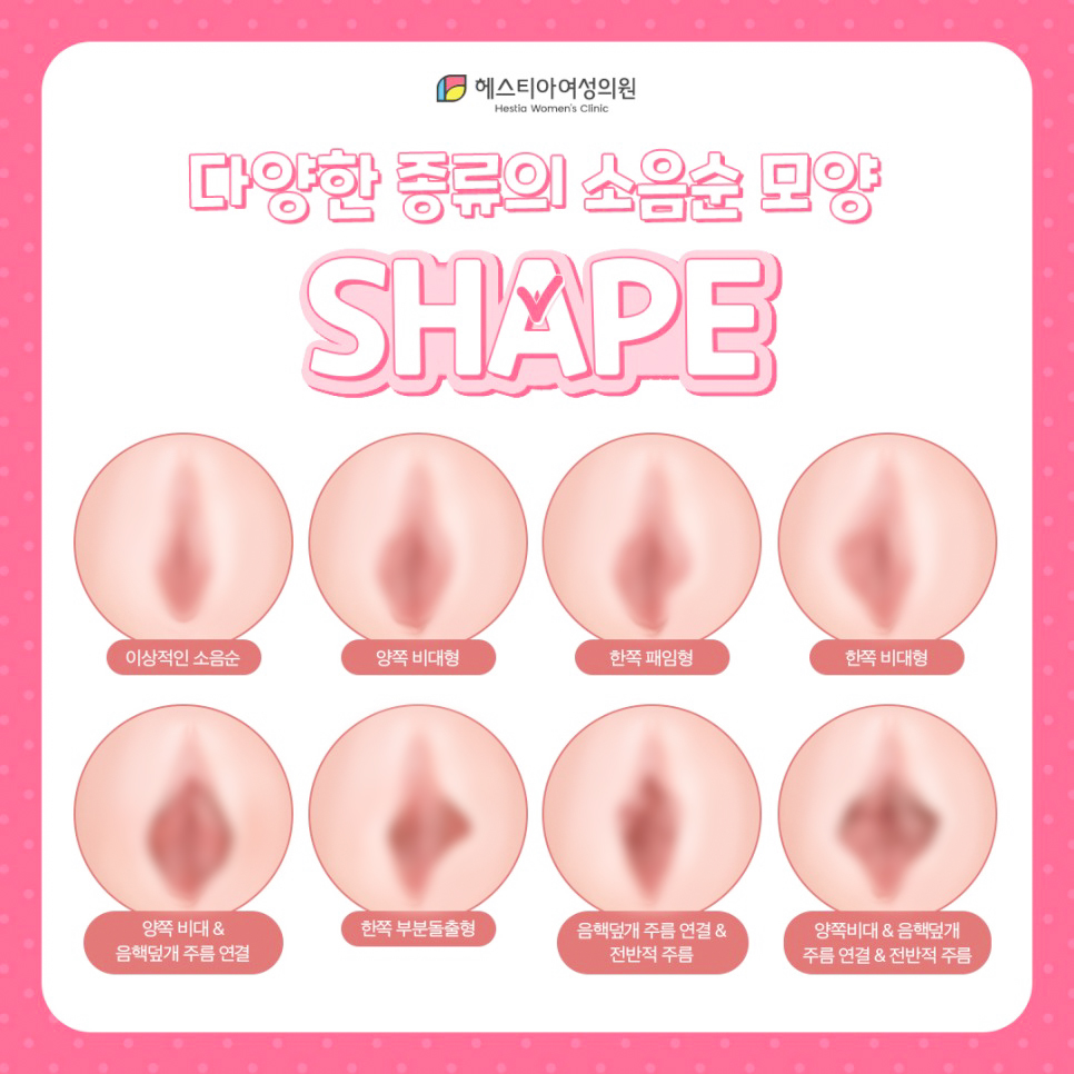 다양한 종류와 소음순 모양