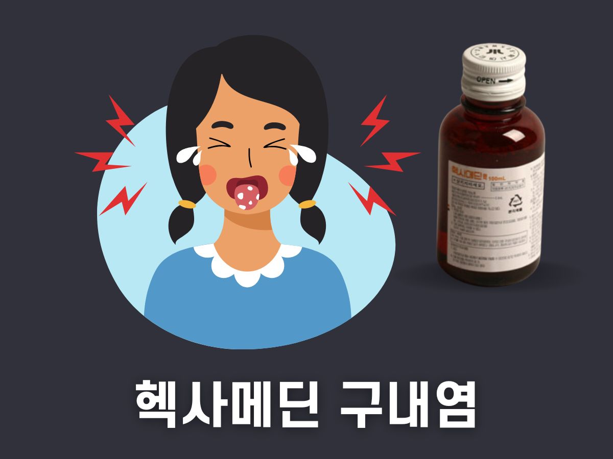 헥사메딘 구내염