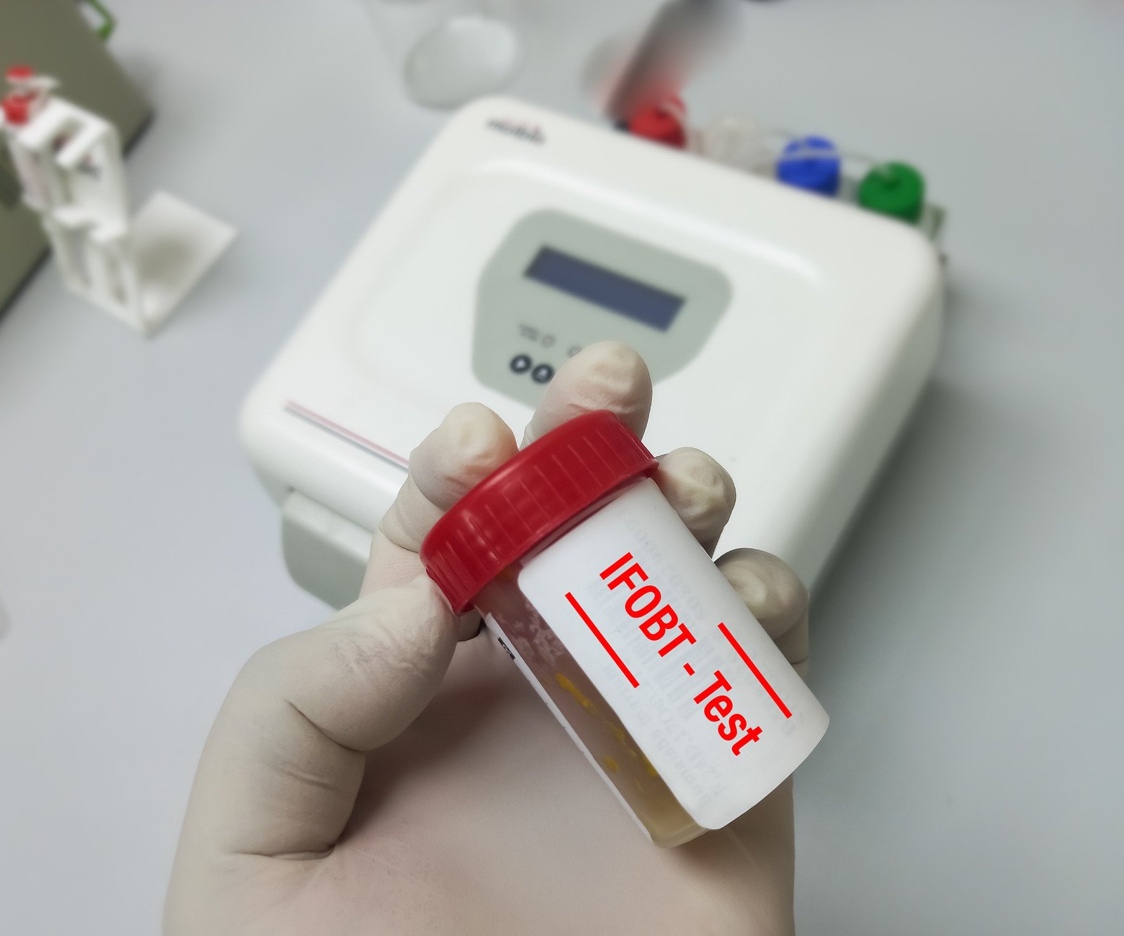 대변 잠혈 검사 (FOBT, FIT): 대장 건강의 첫걸음