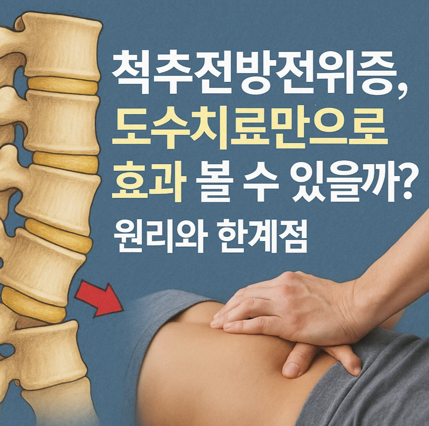 척추전방전위증, 도수치료만으로 효과 볼 수 있을까? 원리와 한계점