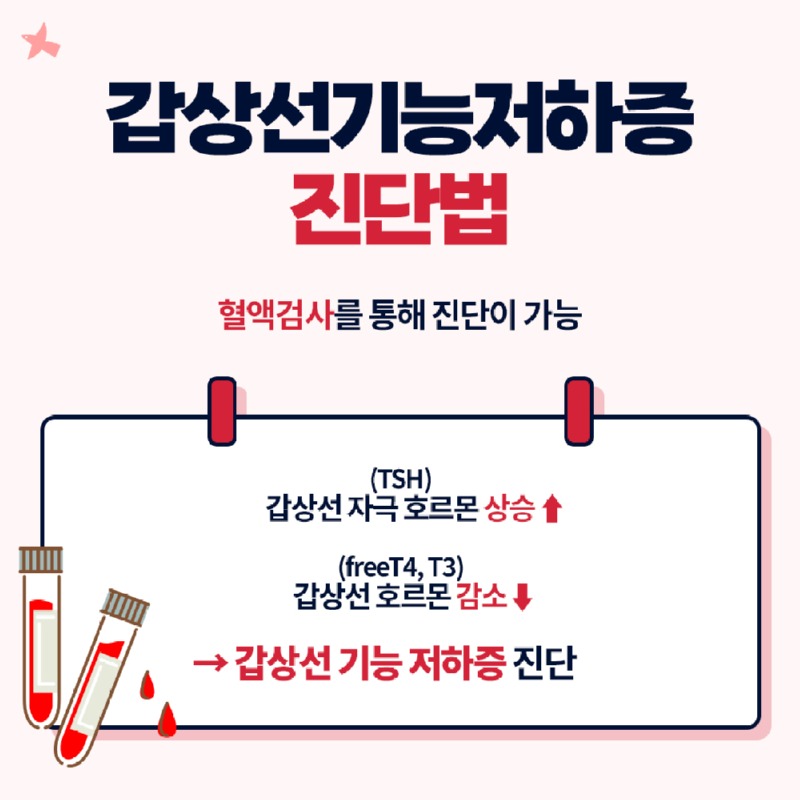 갑상선기능저하증 진단법