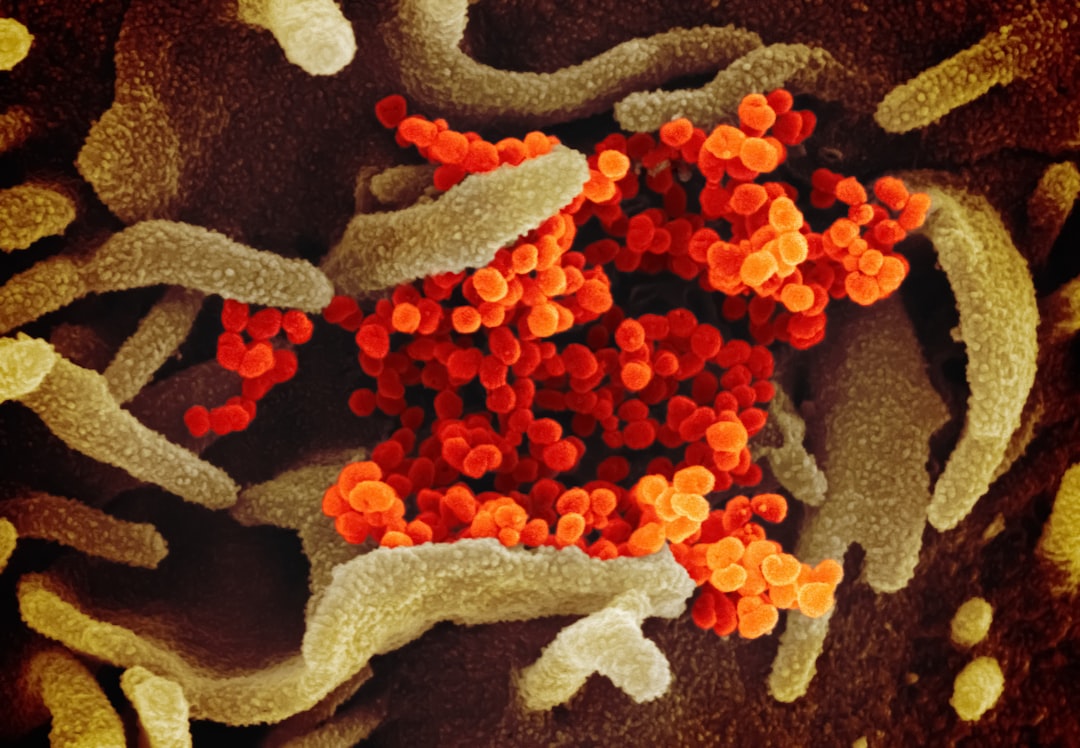 Enzyme