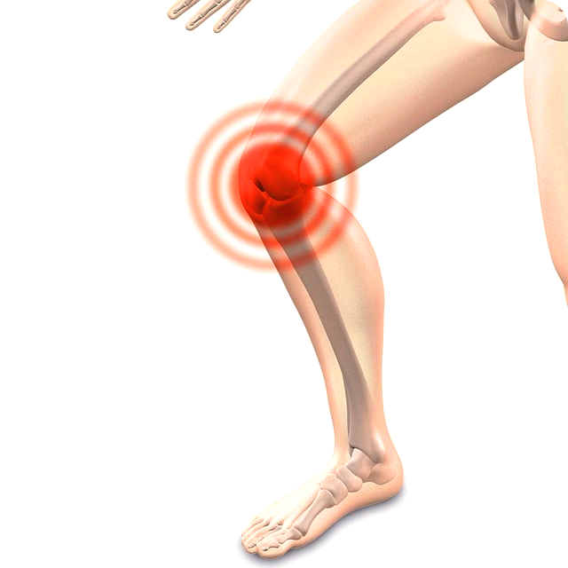 Arthrocalman Osteoarthritis Knee