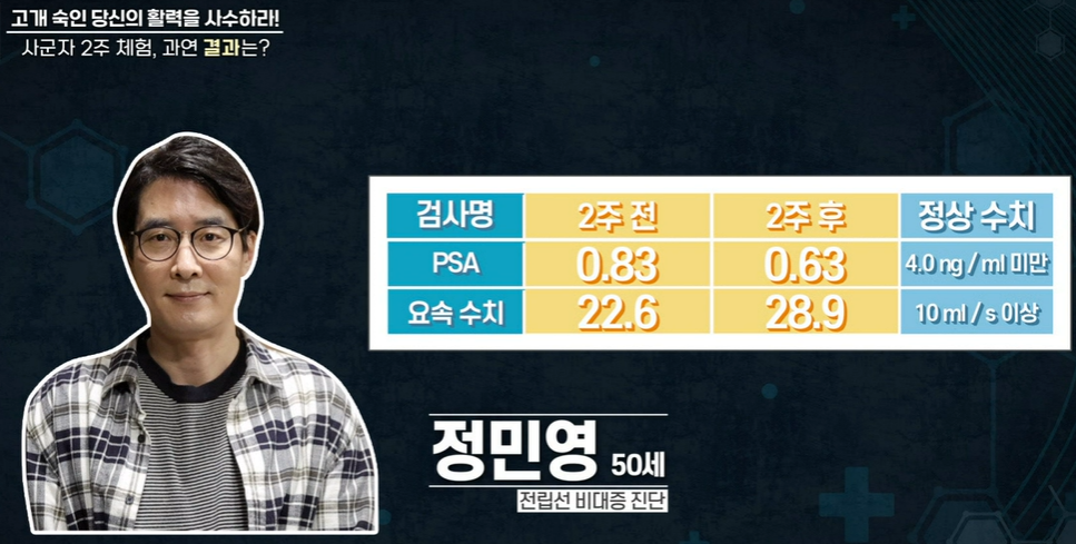 전립선 사군자