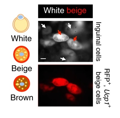 금연과 다이어트의 관계