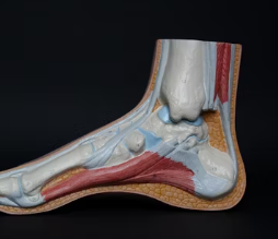 통풍 치료법 진단 기준 합병증