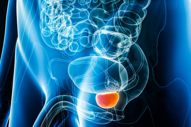 전립선1