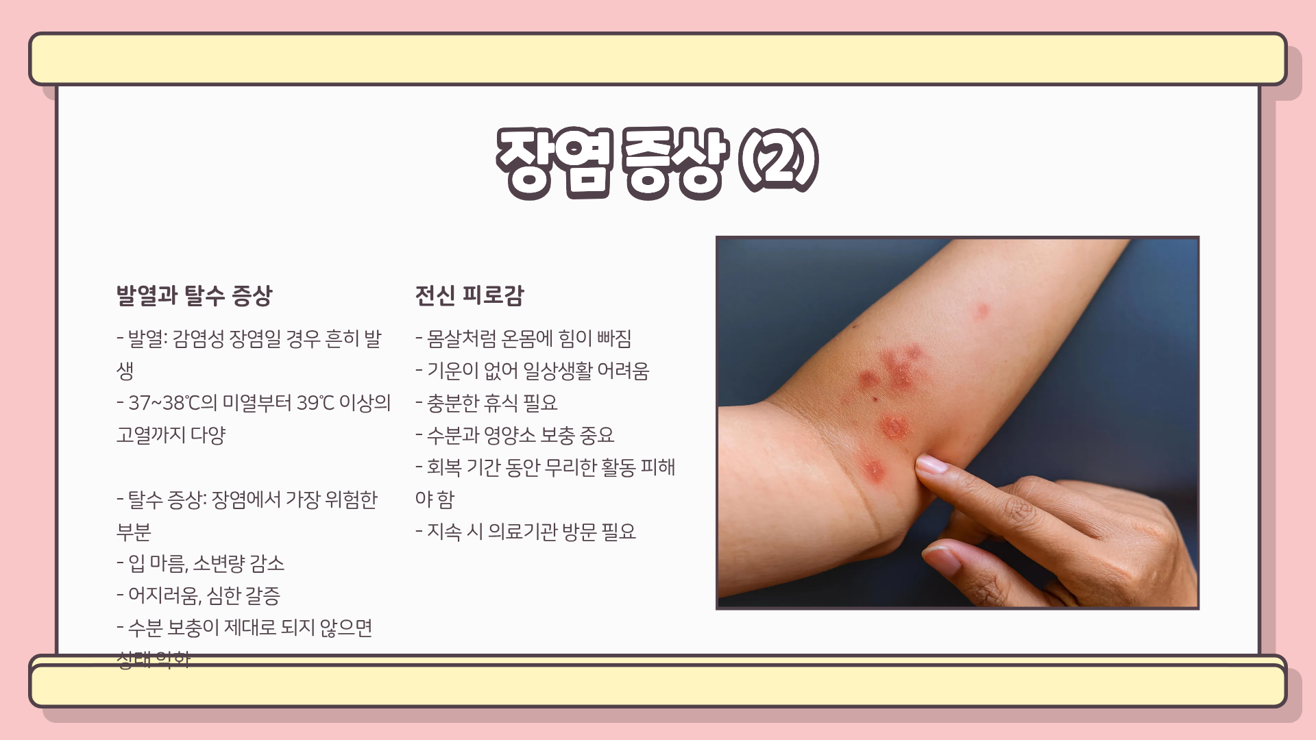 장염 증상 | 장염에 좋은 음식 | 장염 원인 | 장염에 나쁜 음식까지 한눈에 알아보자