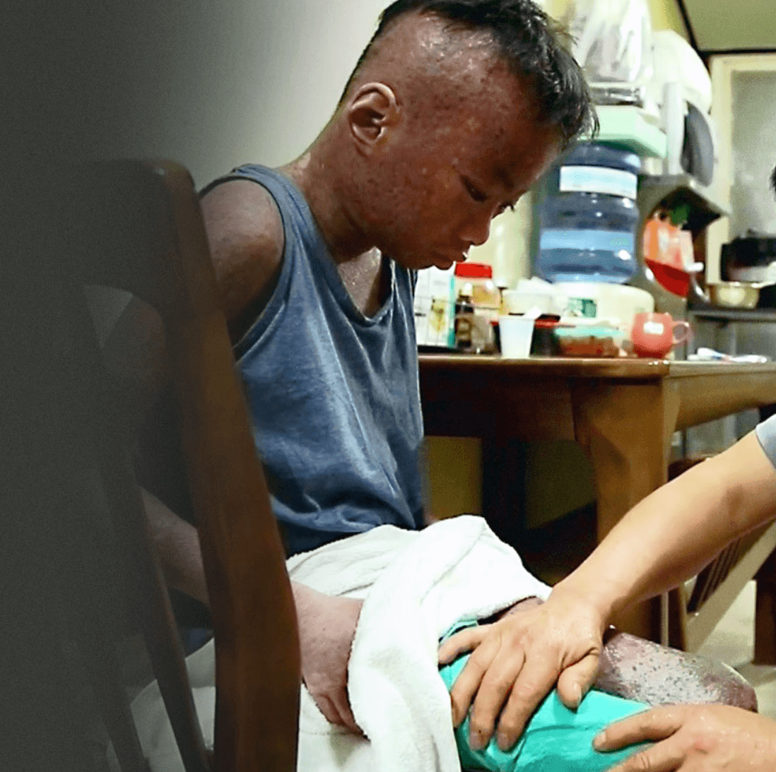 준서의 종기와 피고름2