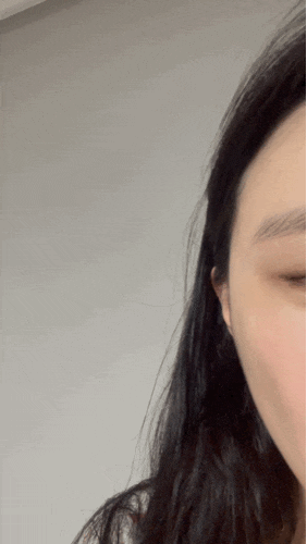 측두근 보톡스 후기