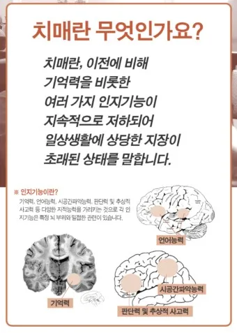 nv_치매 검사_4