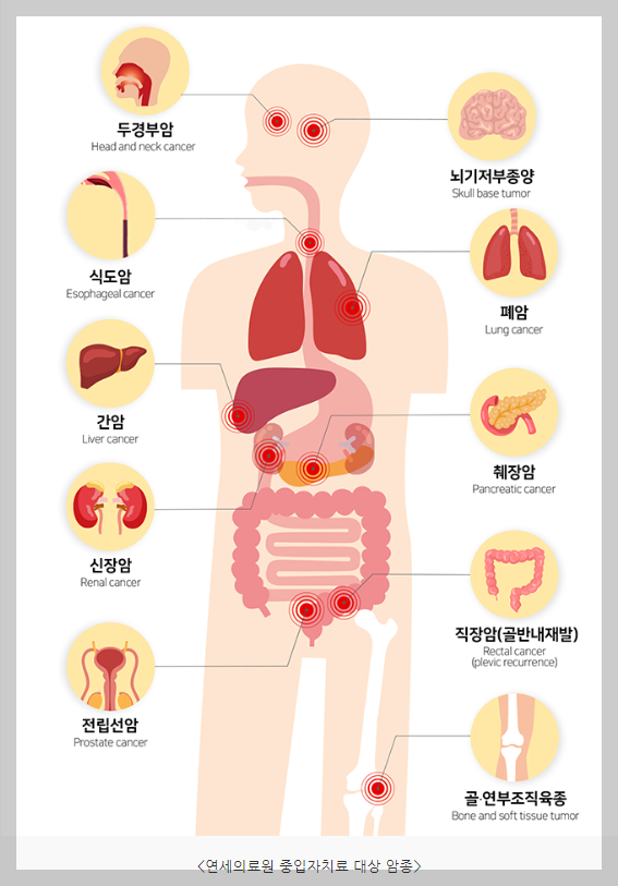 중입자치료의 효과/치료횟수/비용/부작용