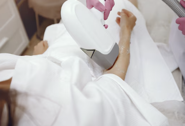 사마귀 제거방법 7