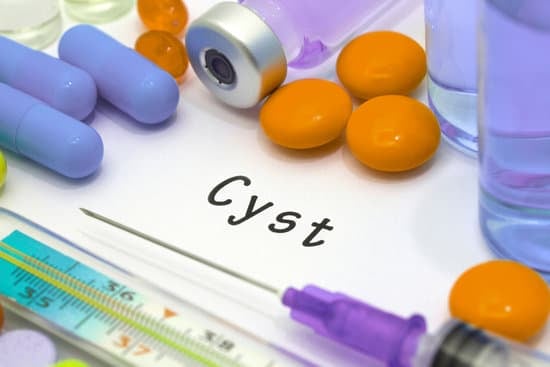 베이커씨 낭종(Baker’s Cyst) – 무릎 뒤쪽에 생기는 물혹