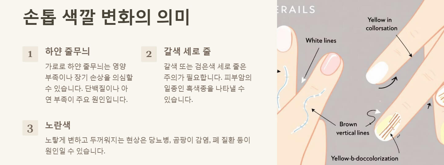 손톱으로 보는 건강상태