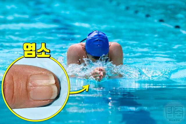 손톱 갈라짐 이유 손톱부러짐 수영장 락스