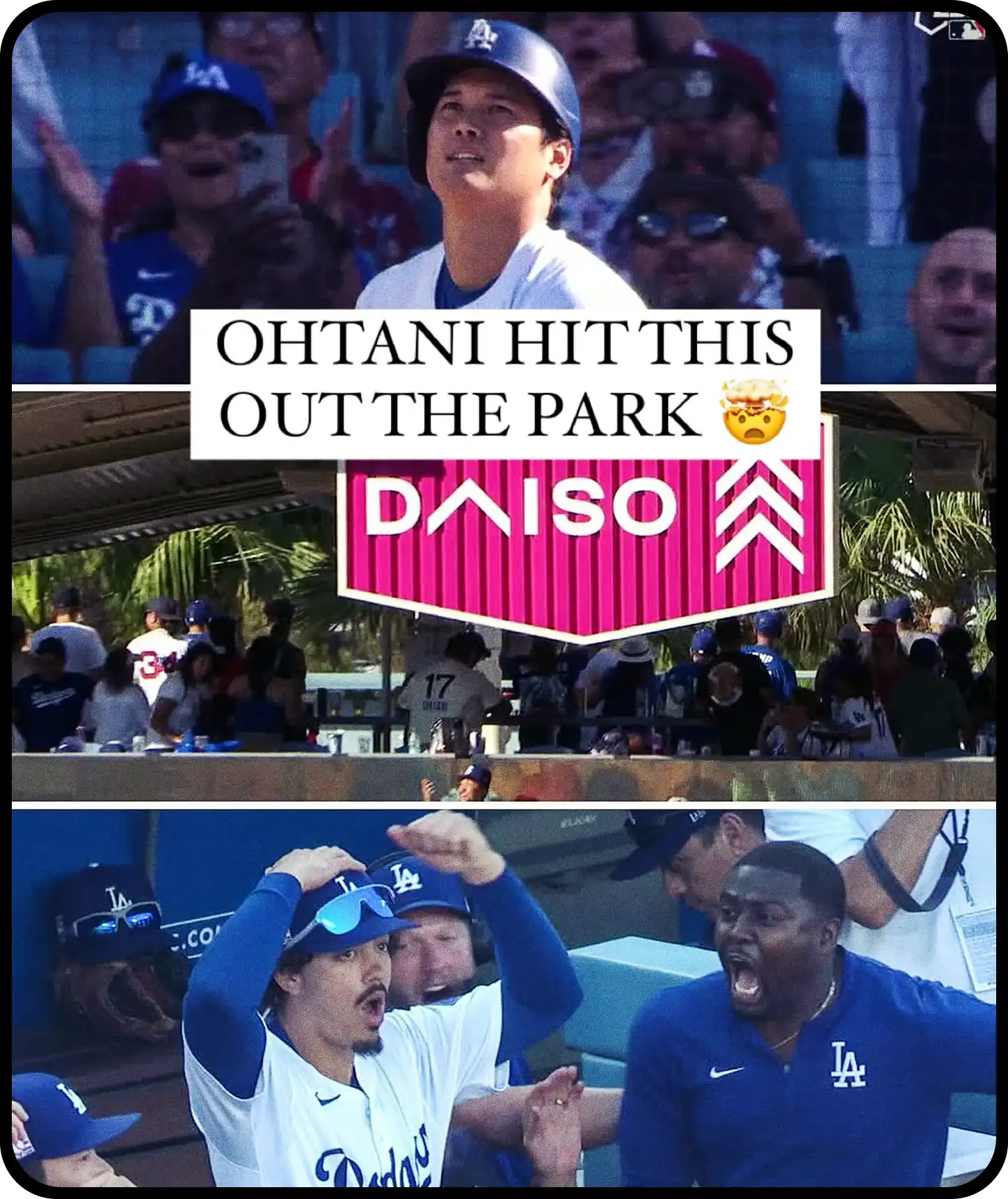 오타니의 투타 겸업, 부상 극복 후 복귀 준비 과정과 목표