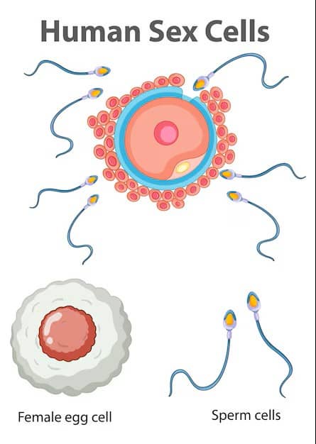 성염색체 이상 질환