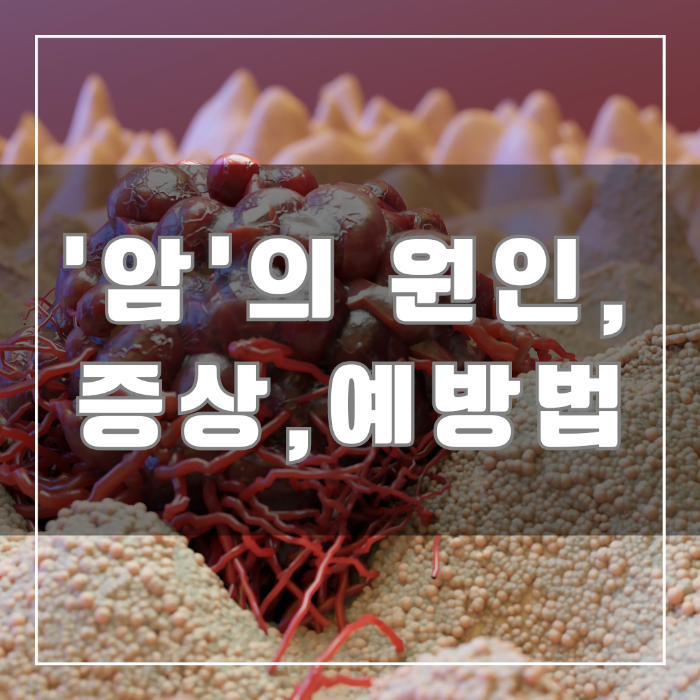 암의 원인 증상 예방법