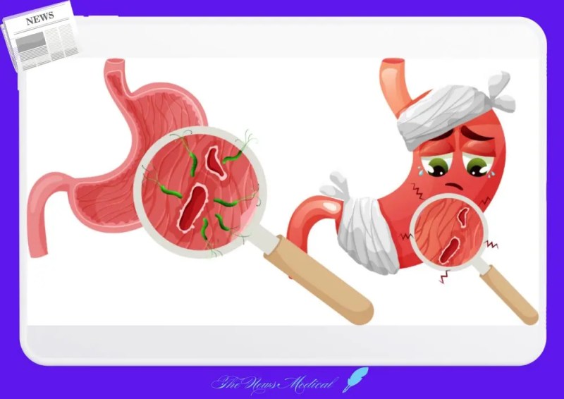헬리코박터 파일로리균(H. pylori)은 위 점막에 사는 세균으로, 전 세계 인구의 약 50%가 감염된 것으로 알려져 있다.