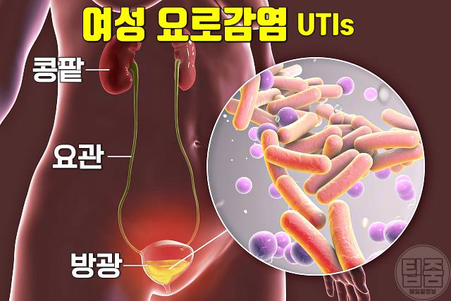 간에 좋은 차 민들레차 효능 요로감염 민들레차부작용