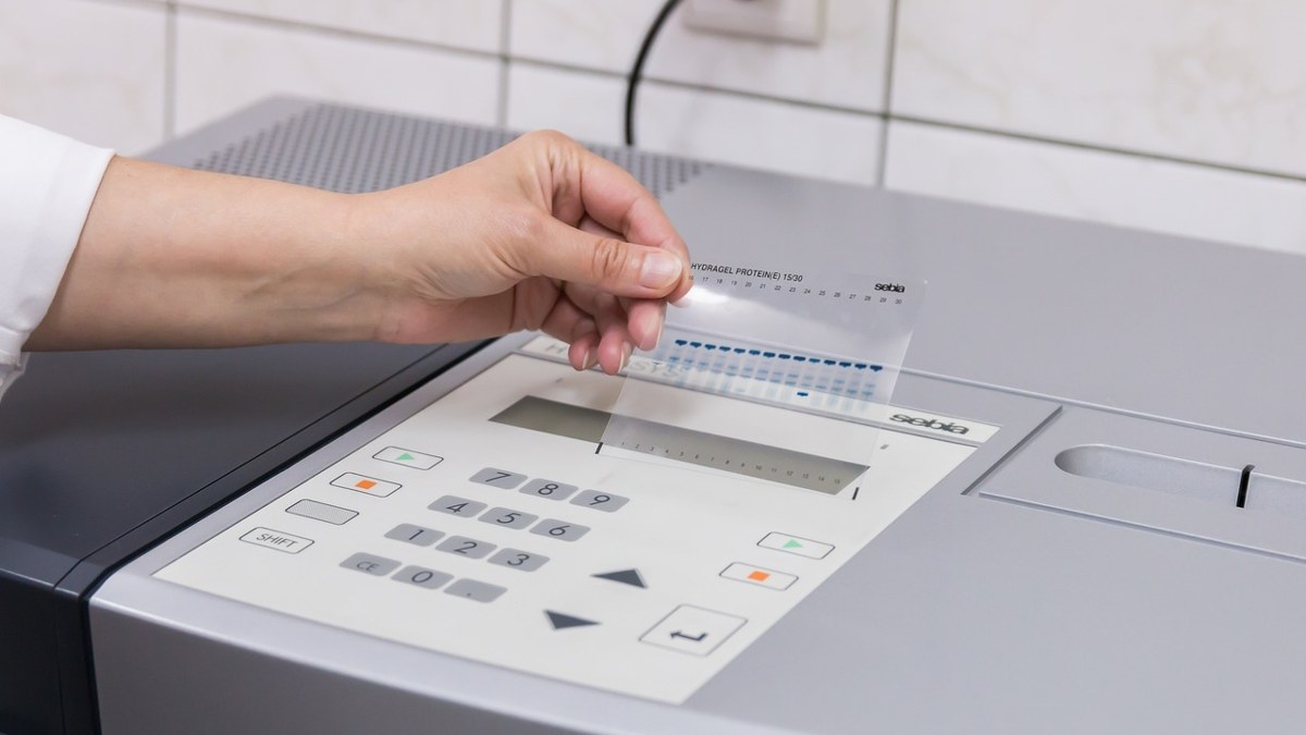 근전도검사를 위해 전극을 부착하는 장면