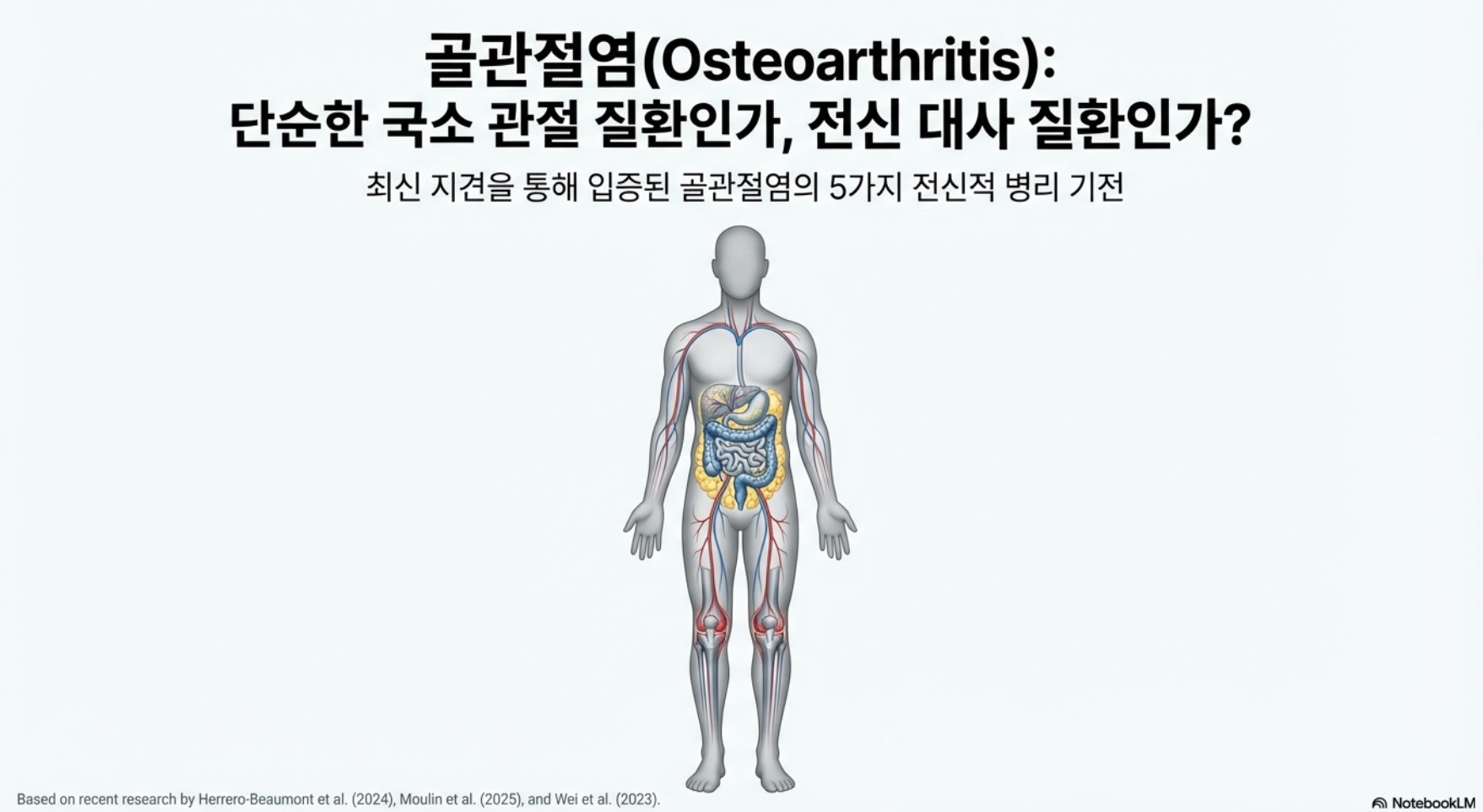 무릎 관절염, 대사질환일까 국소질환일까.