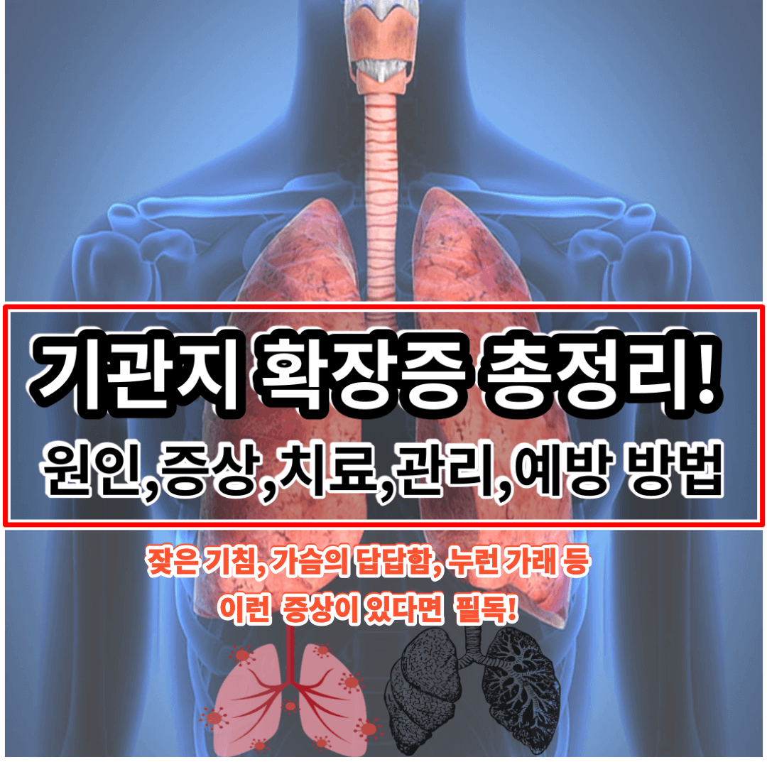 기관지 확장증 증상 원인 치료 관리 예방 방법