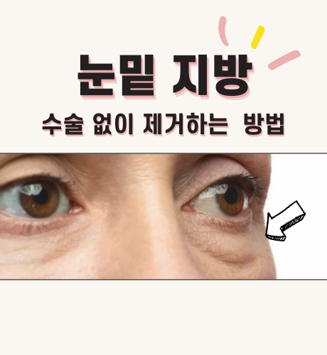 눈밑 지방 제거