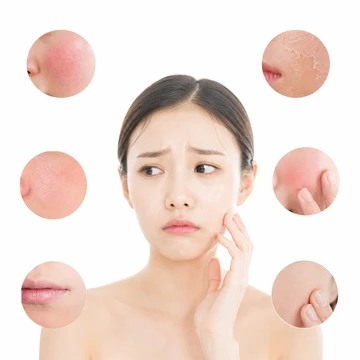 피부장벽 약화로 인한 변화 모습3