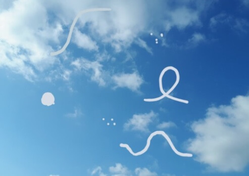 브로멜라인과 비문증