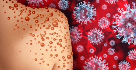 아데노 바이러스