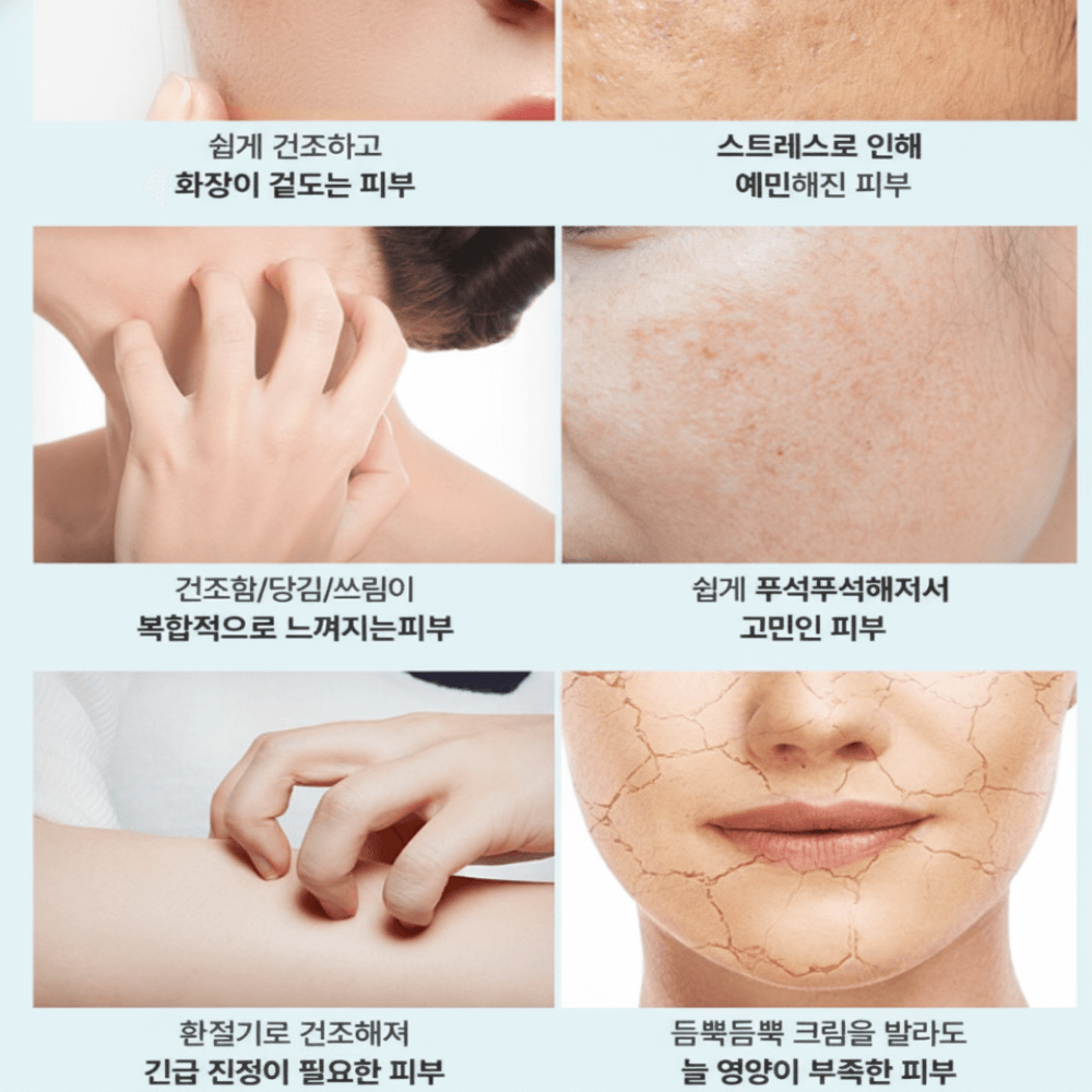 듀이셀 이더블시카크림이 필요한 이유