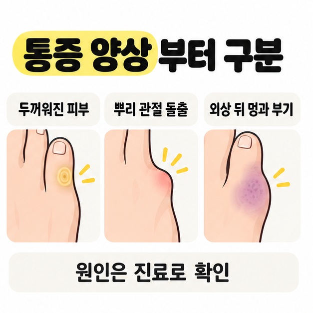 두꺼워진 피부와 뿌리 관절 돌출, 외상 뒤 멍과 부기의 세 가지 모습을 비교하고 원인은 진료로 확인하도록 안내한 그림