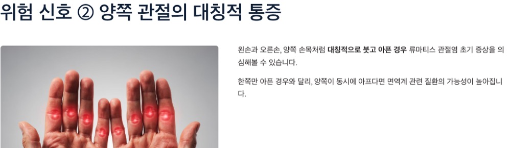 류마티스 관절염 위험신호 대칭적신호