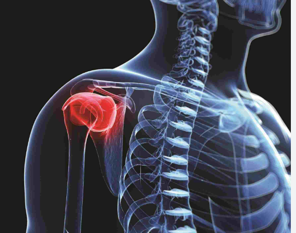 어깨 통증 원인