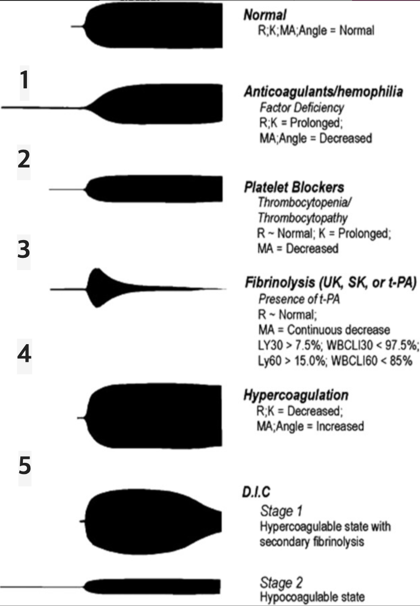 TEG_various_graphs