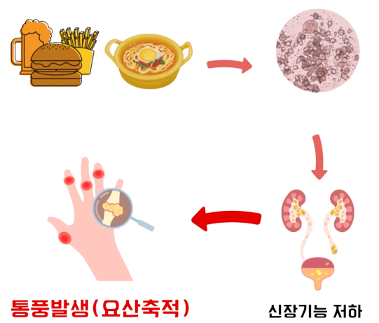 통풍발작 응급 대처 치료 방법 - 소염진통제 복용