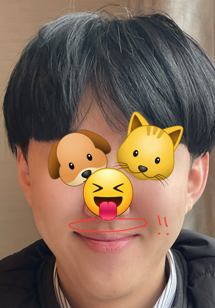 수염제모후 콧수염으로부터 자유로워진 내 사진1