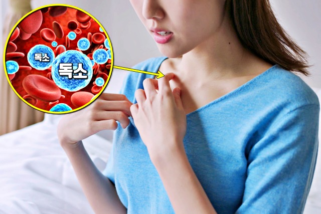 콩팥이 안좋을때 증상,가려움증,콩팥이 안좋으면 나타나는 증상