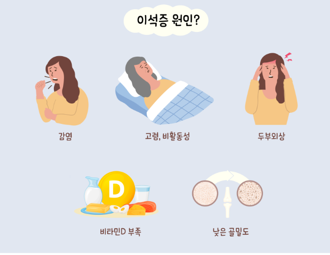 이석증 재발 막는 법