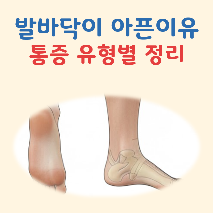 발바닥이 아픈이유 대표 이미지