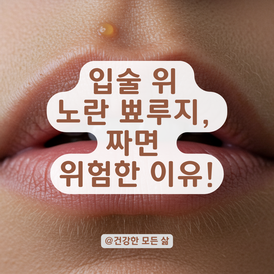 짜지 말고 확인하세요! 입술 위 노란 뾰루지로 시작되는 감염 사례 정리.